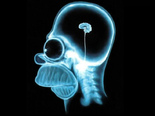 Homer Brain X-Ray